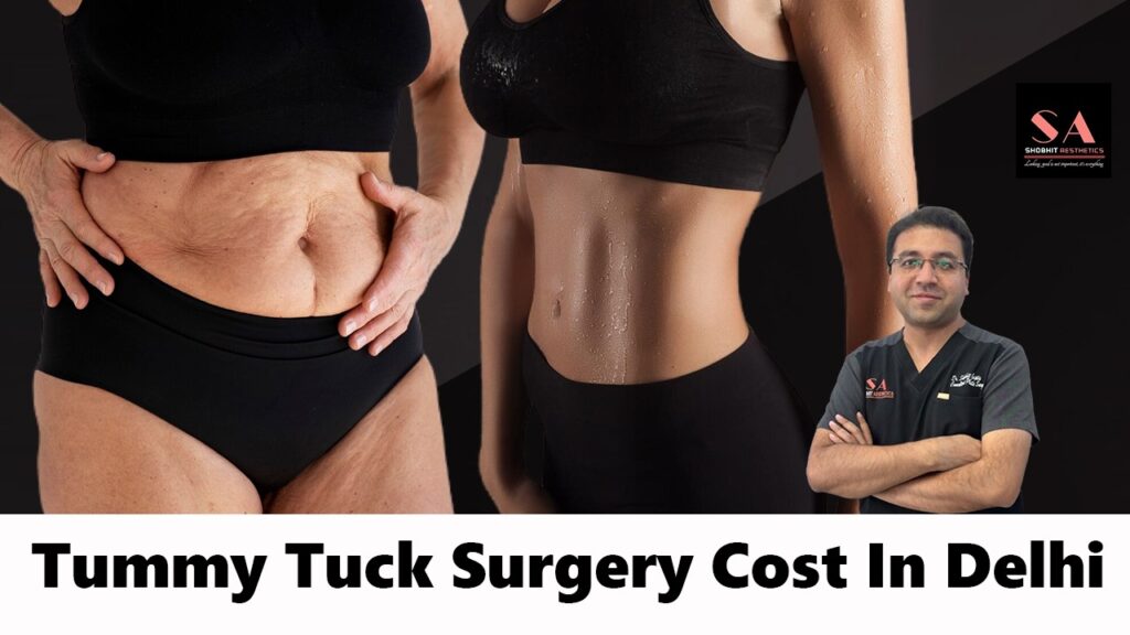 tummy tuck surgery in Delhi